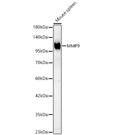 MMP9 Rabbit Polyclonal Antibody