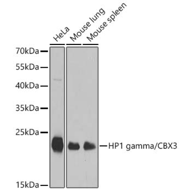HP1 gamma/CBX3 Rabbit Polyclonal Antibody