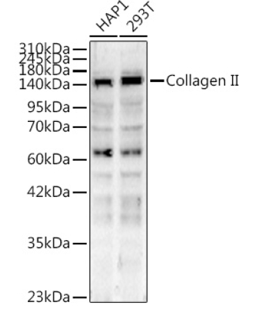 Collagen II Rabbit Polyclonal Antibody