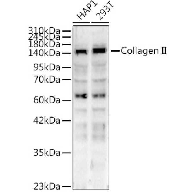 Collagen II Rabbit Polyclonal Antibody