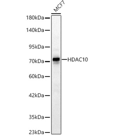 HDAC10 Rabbit Polyclonal Antibody [KD Validated]