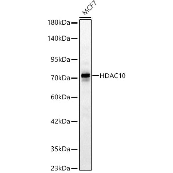 HDAC10 Rabbit Polyclonal Antibody [KD Validated]