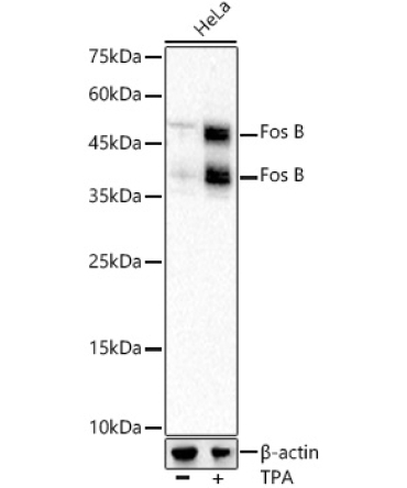 Fos B Rabbit Monoclonal Antibody