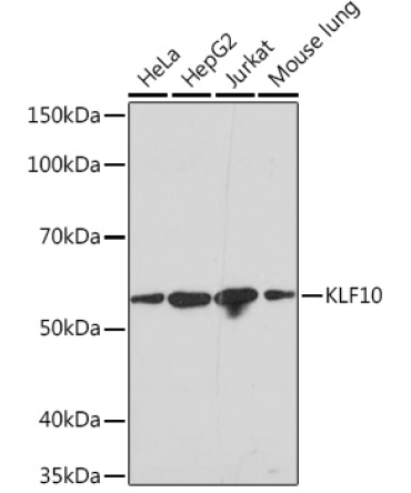 KLF10 Rabbit Monoclonal Antibody