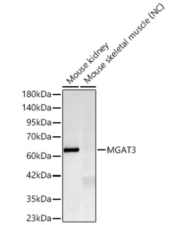 MGAT3 Rabbit Monoclonal Antibody
