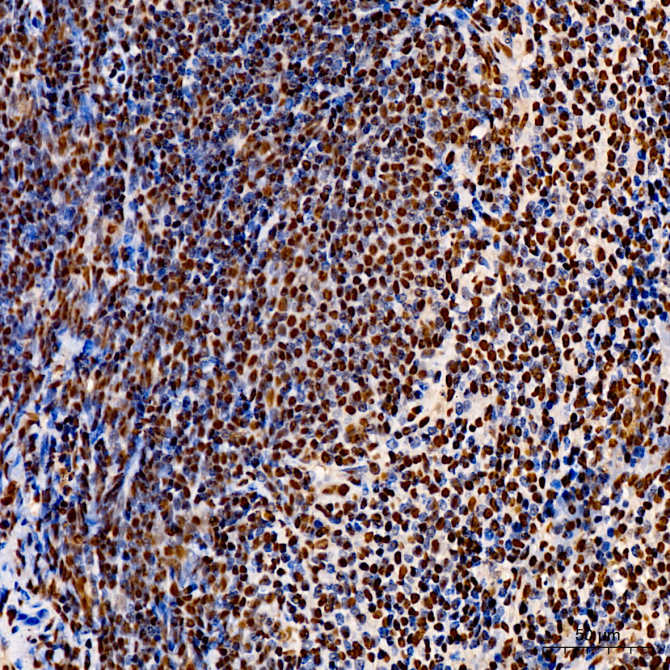 EP300 Rabbit Polyclonal Antibody