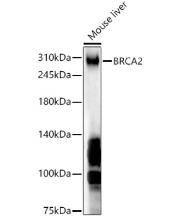 BRCA2 Rabbit Polyclonal Antibody