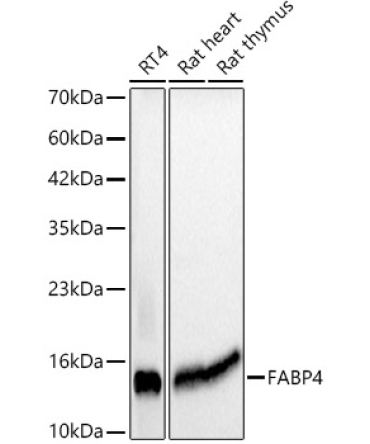FABP4 Mouse Monoclonal Antibody