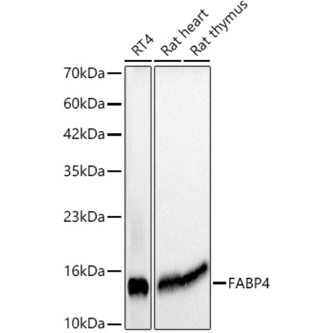 FABP4 Mouse Monoclonal Antibody