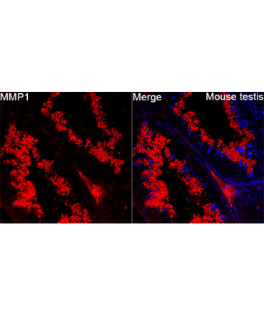 MMP-1 Rabbit Polyclonal Antibody