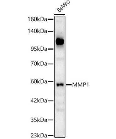 MMP1 Rabbit Polyclonal Antibody