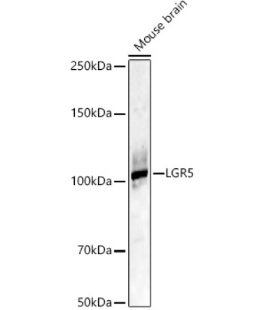 LGR5 Rabbit Polyclonal Antibody