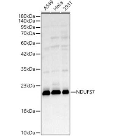 NDUFS7 Rabbit Polyclonal Antibody