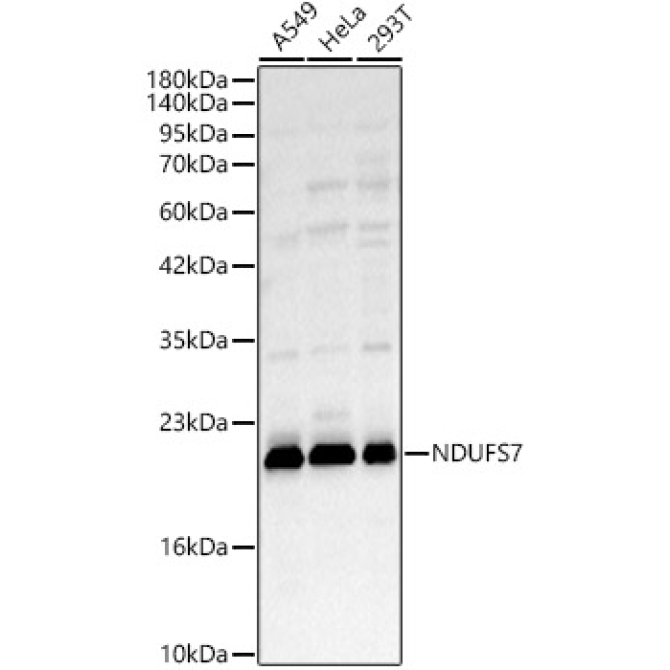 NDUFS7 Rabbit Polyclonal Antibody