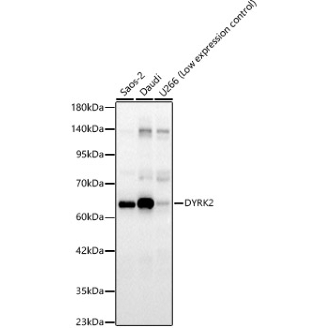 DYRK2 Rabbit Polyclonal Antibody