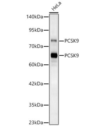 PCSK9 Rabbit Polyclonal Antibody