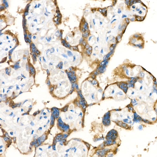KISS1 Rabbit Polyclonal Antibody