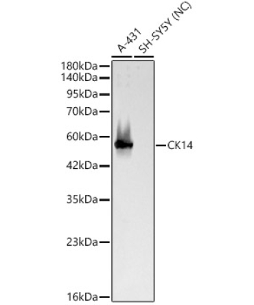 CK14 Rabbit Polyclonal Antibody