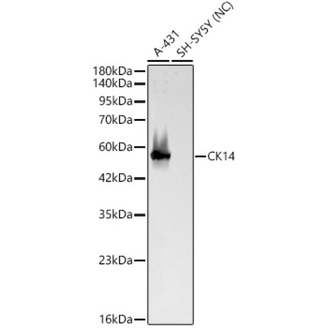 CK14 Rabbit Polyclonal Antibody
