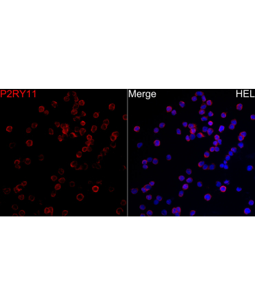 P2RY11 Rabbit Polyclonal Antibody