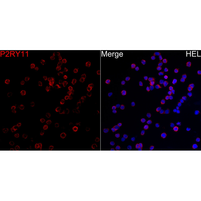 P2RY11 Rabbit Polyclonal Antibody