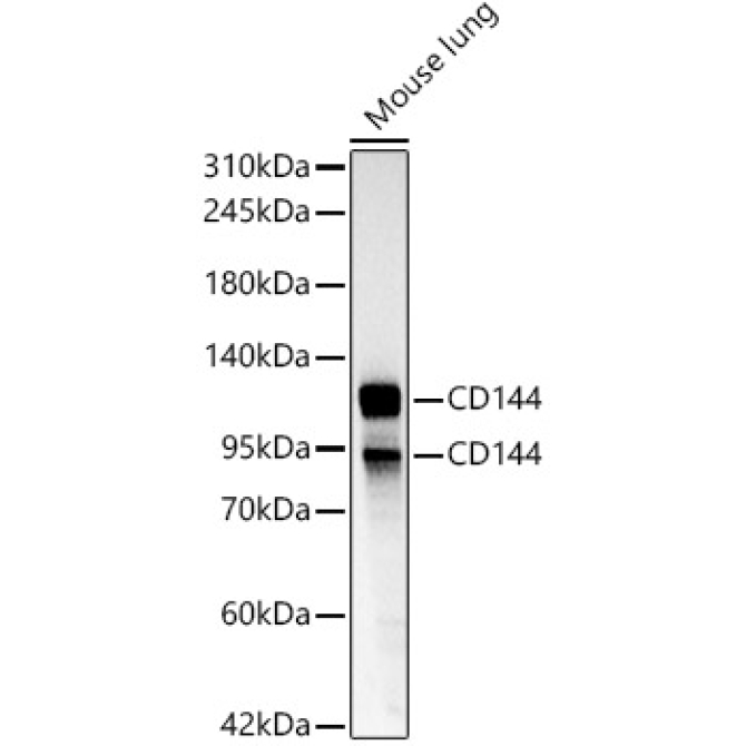 CD144 Rabbit Polyclonal Antibody