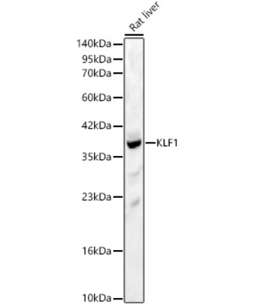 KLF1 Rabbit Polyclonal Antibody
