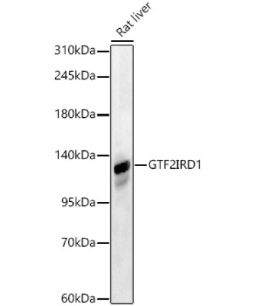 GTF2IRD1 Rabbit Polyclonal Antibody