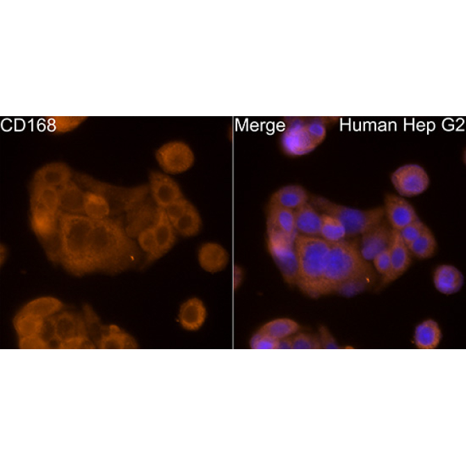 CD168 Rabbit Polyclonal Antibody