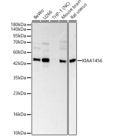 KIAA1456 Rabbit Polyclonal Antibody