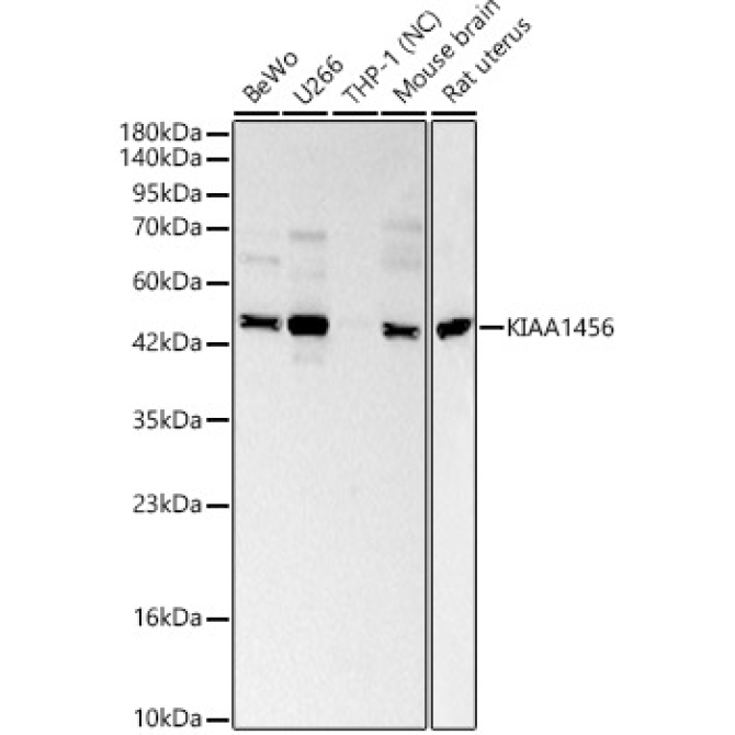 KIAA1456 Rabbit Polyclonal Antibody