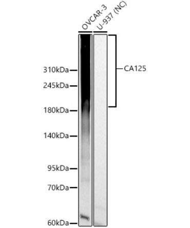 CA125 Rabbit Polyclonal Antibody