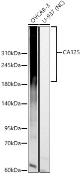 CA125 Rabbit Polyclonal Antibody