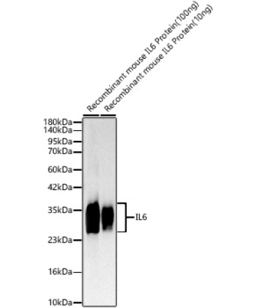 IL6 Rabbit Polyclonal Antibody