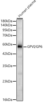 GPVI/GP6 Rabbit Polyclonal Antibody