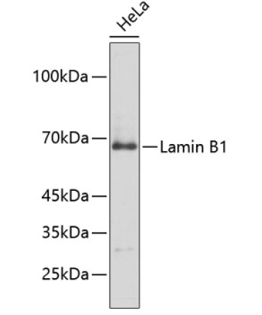Lamin B1 Rabbit Polyclonal Antibody