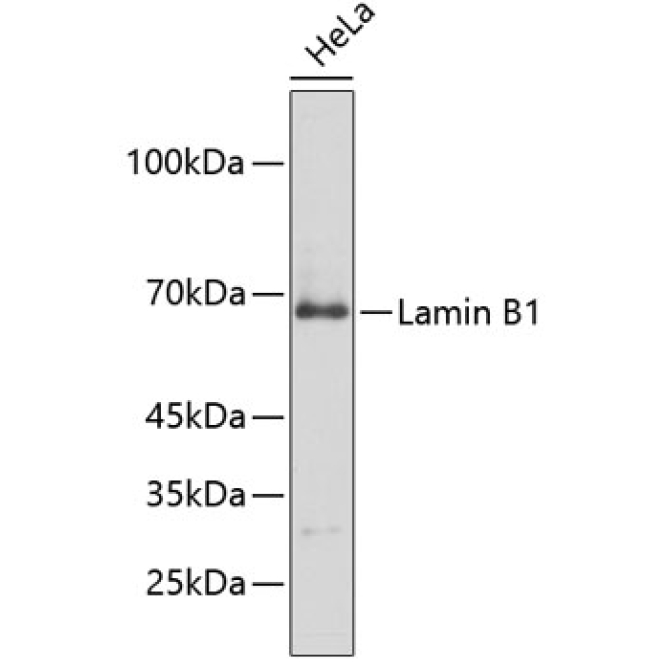 Lamin B1 Rabbit Polyclonal Antibody