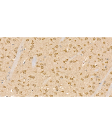 CLPB Rabbit Polyclonal Antibody