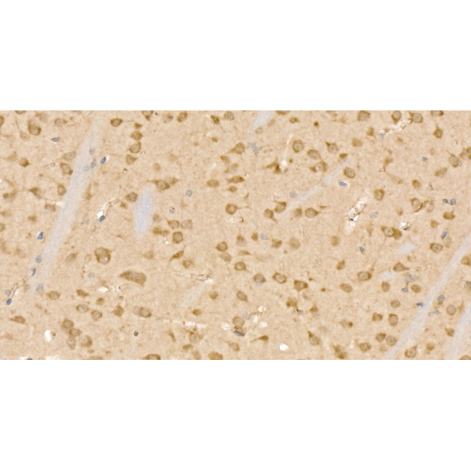 CLPB Rabbit Polyclonal Antibody