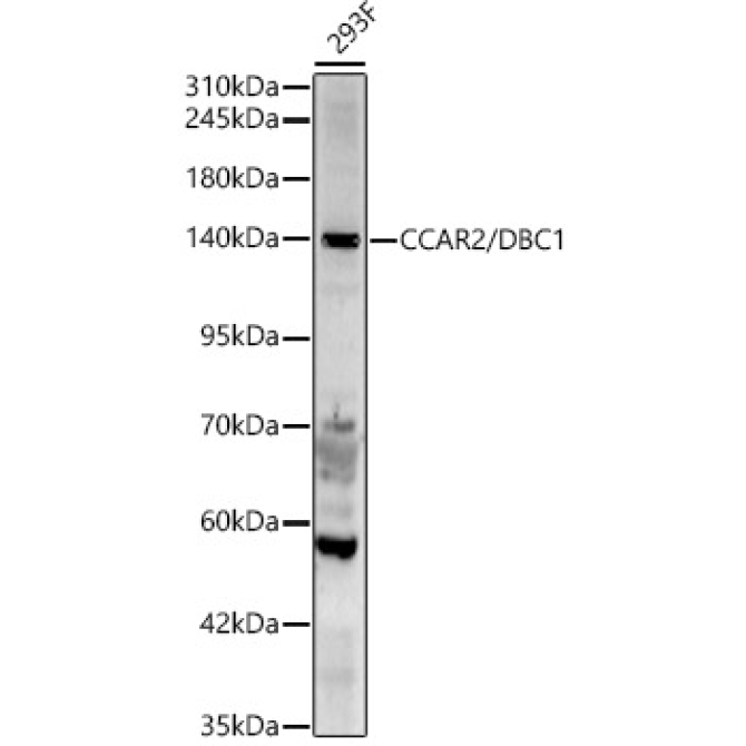 CCAR2/DBC1 Rabbit Polyclonal Antibody