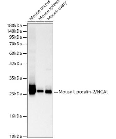 Lipocalin-2/NGAL Rabbit Polyclonal Antibody