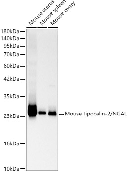 Lipocalin-2/NGAL Rabbit Polyclonal Antibody