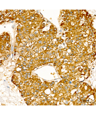 nm23 Rabbit Polyclonal Antibody