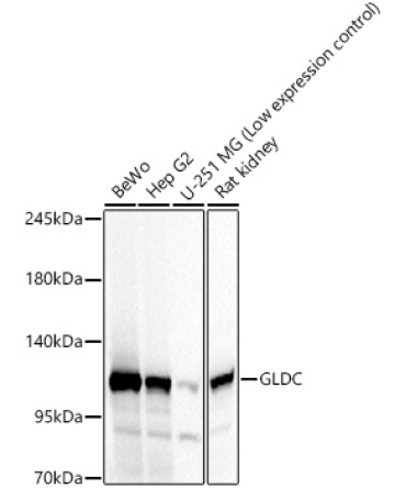 GLDC Rabbit Polyclonal Antibody