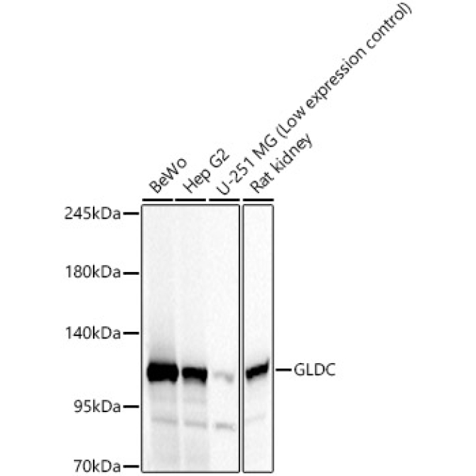 GLDC Rabbit Polyclonal Antibody
