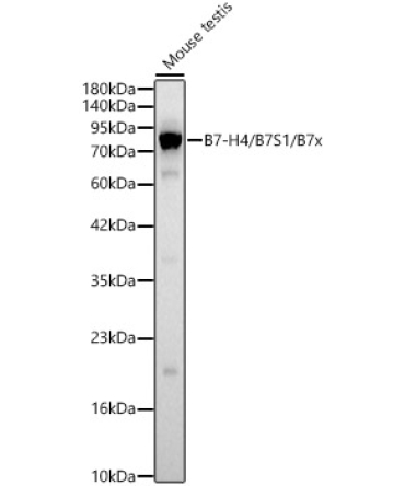 B7-H4 / B7S1 / B7x Rabbit Polyclonal Antibody
