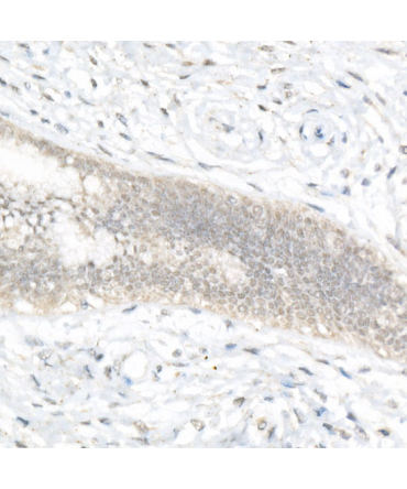 FOXQ1 Rabbit Polyclonal Antibody