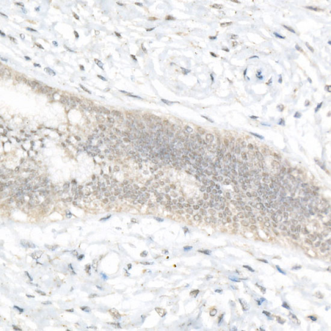 FOXQ1 Rabbit Polyclonal Antibody