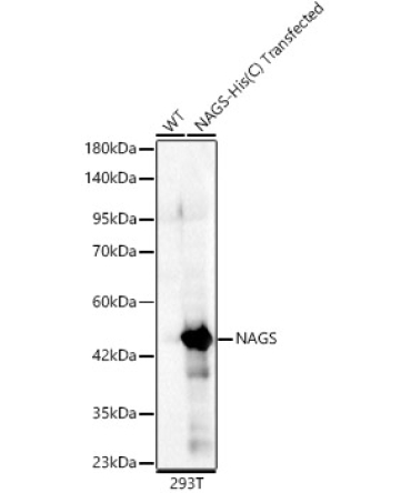 NAGS Rabbit Polyclonal Antibody