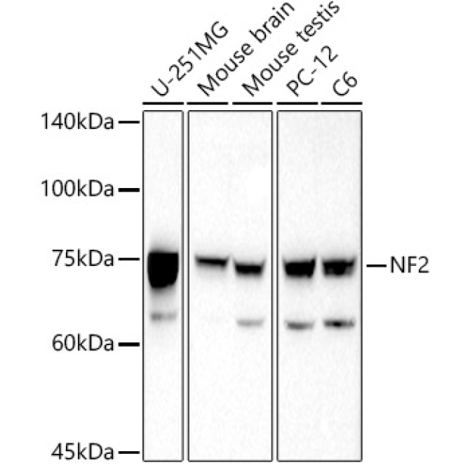 NF2 Rabbit Polyclonal Antibody